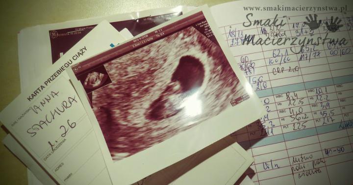 Karta przebiegu ciąży